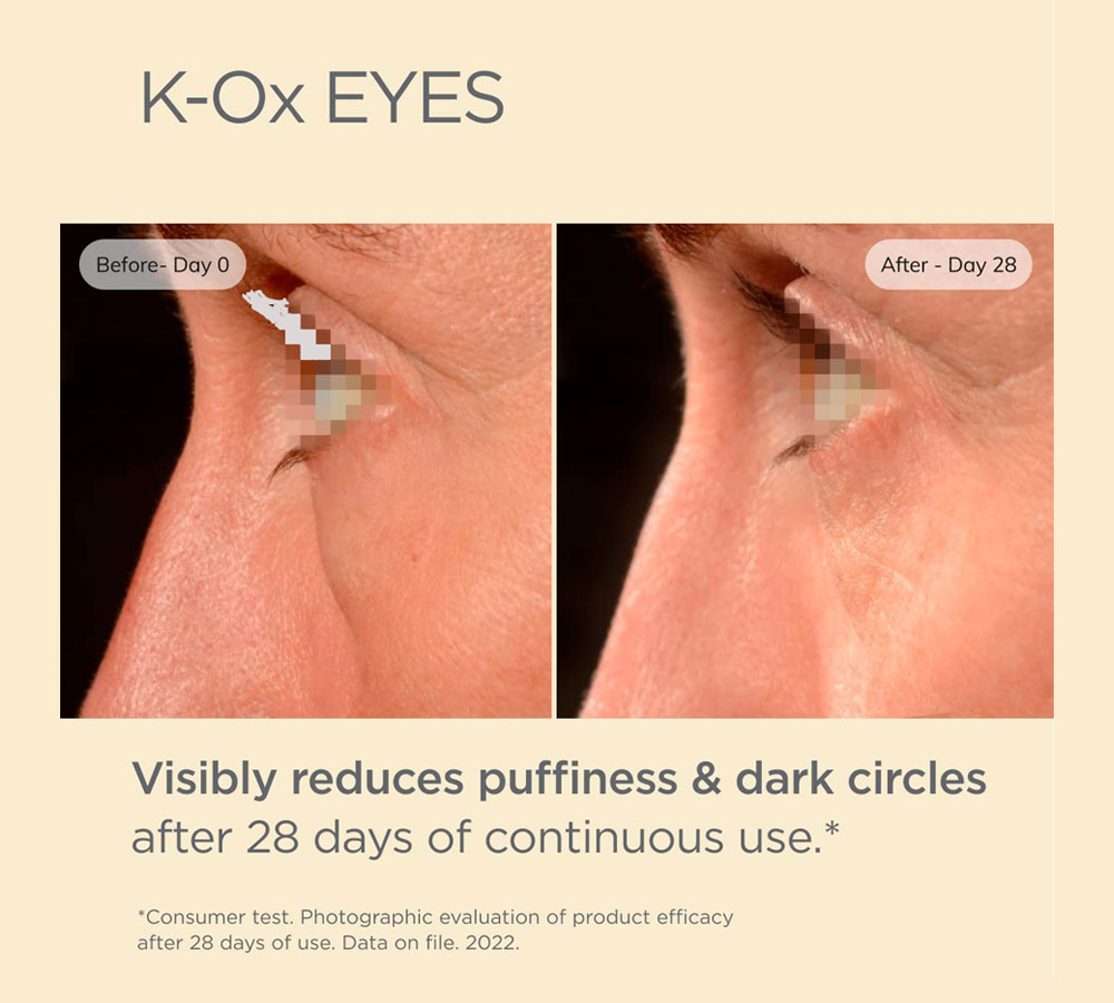 under-eye-cream-isdinceutics-k-ox-eyes-maya-04