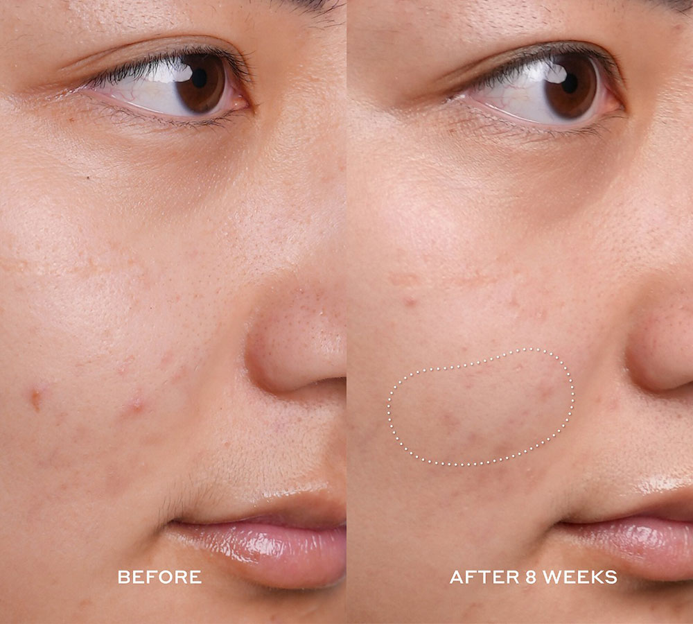 ole-henriksen-banana-bright-vitamin-c-serum-maya-03