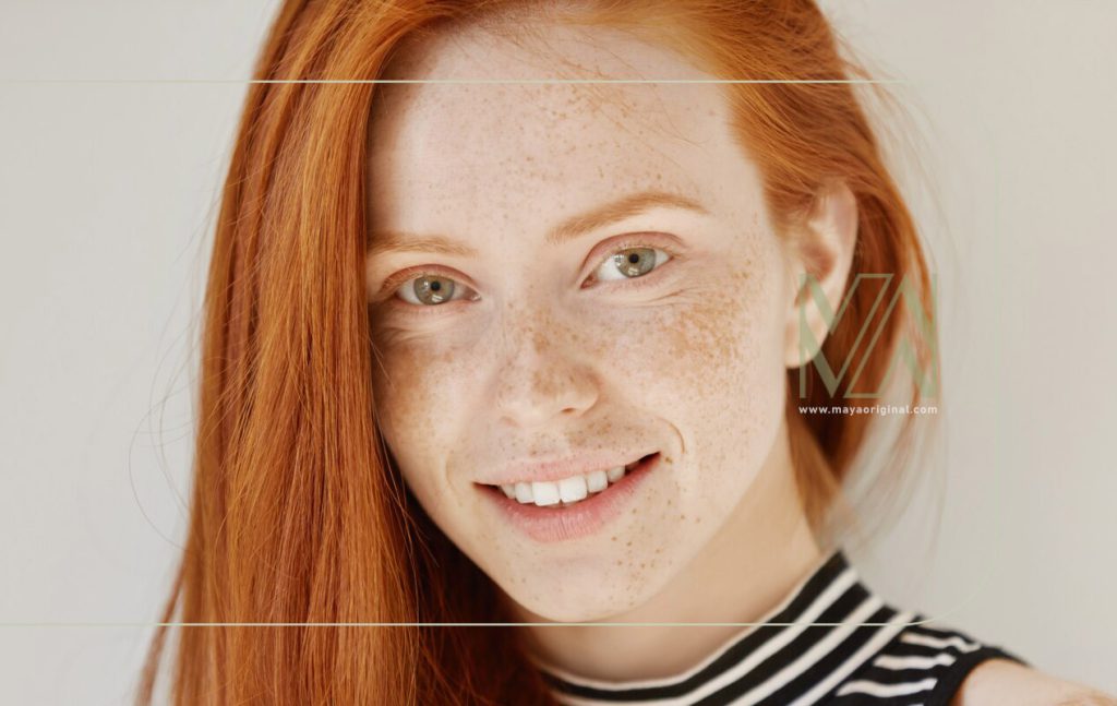 ملاسما چیست