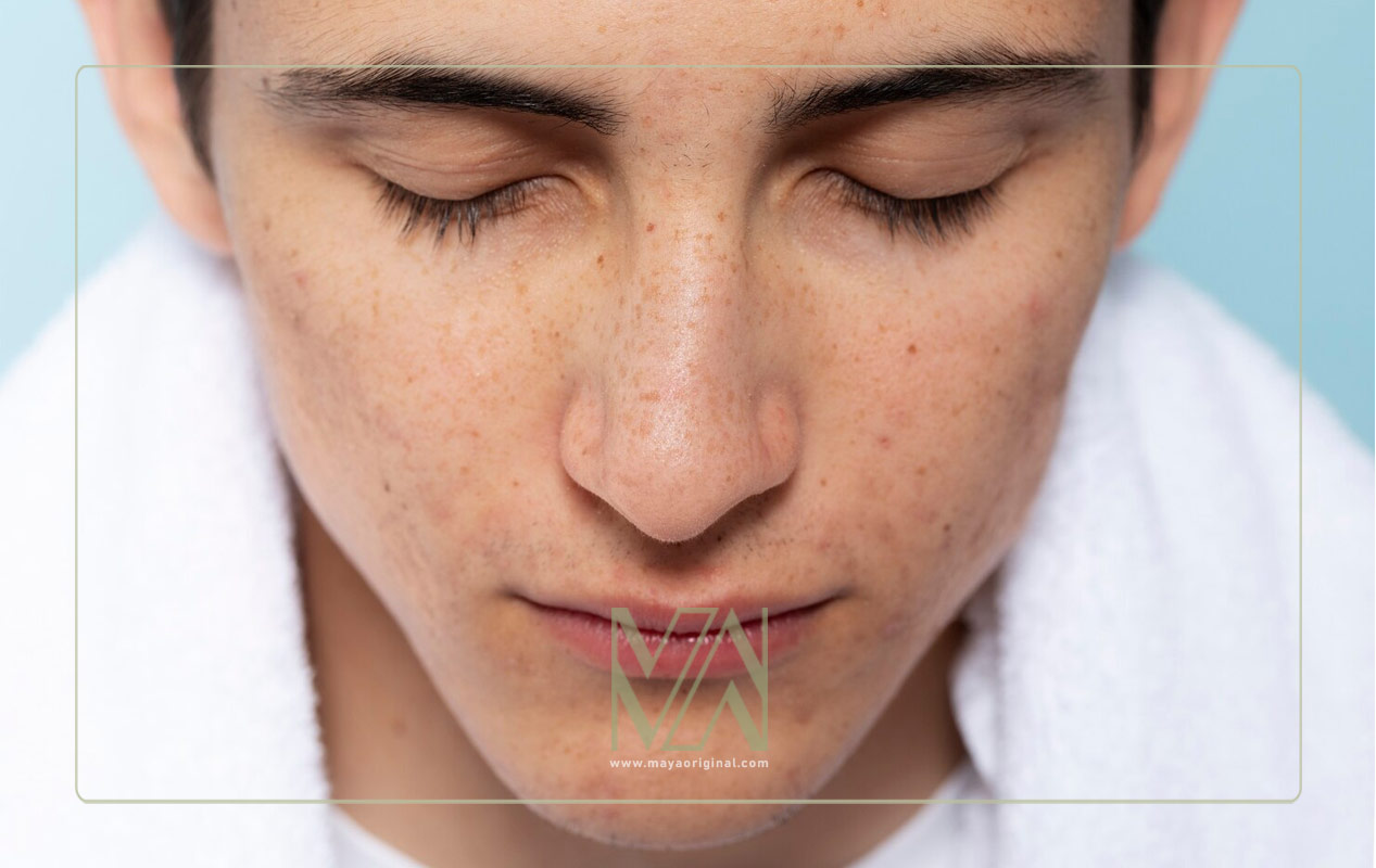 راه های پیشگیری ملاسما