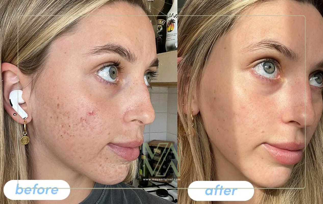 تفاوت عملکرد کلاژن و پپتید کلاژن