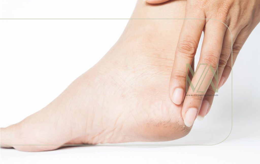 اگزما و راه های درمان آن