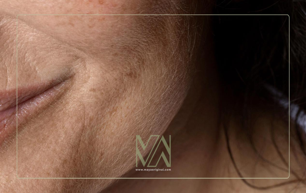 بهترین سن برای جلوگیری از افتادگی صورت