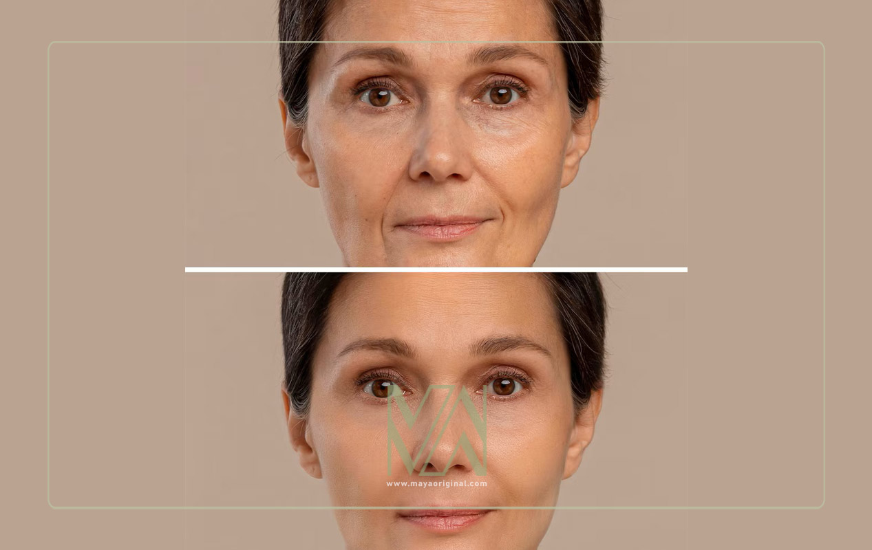 راه های مراقبت از پوست در برابر افتادگی پوست