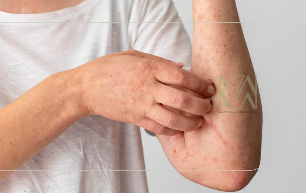 دلایل خارش پوست و روش های درمان آن