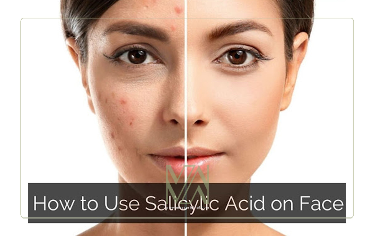 سالیسیلیک اسید را به چه صورت مصرف کنیم؟