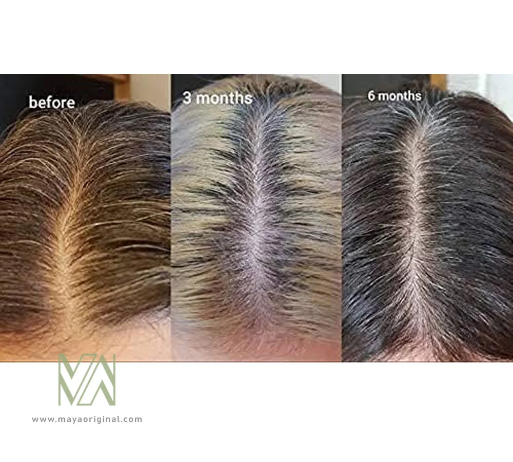 سرم مولتی پپتید اوردینری