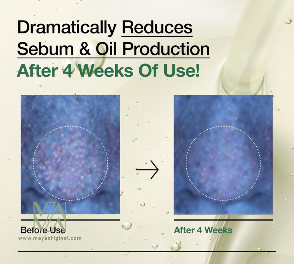 ANUA-Heartleaf-Pore-Cleansing-Oil-MILD-maya-03 روغن پاک کننده و کنترل منافذ Heartleaf آنوا اصل