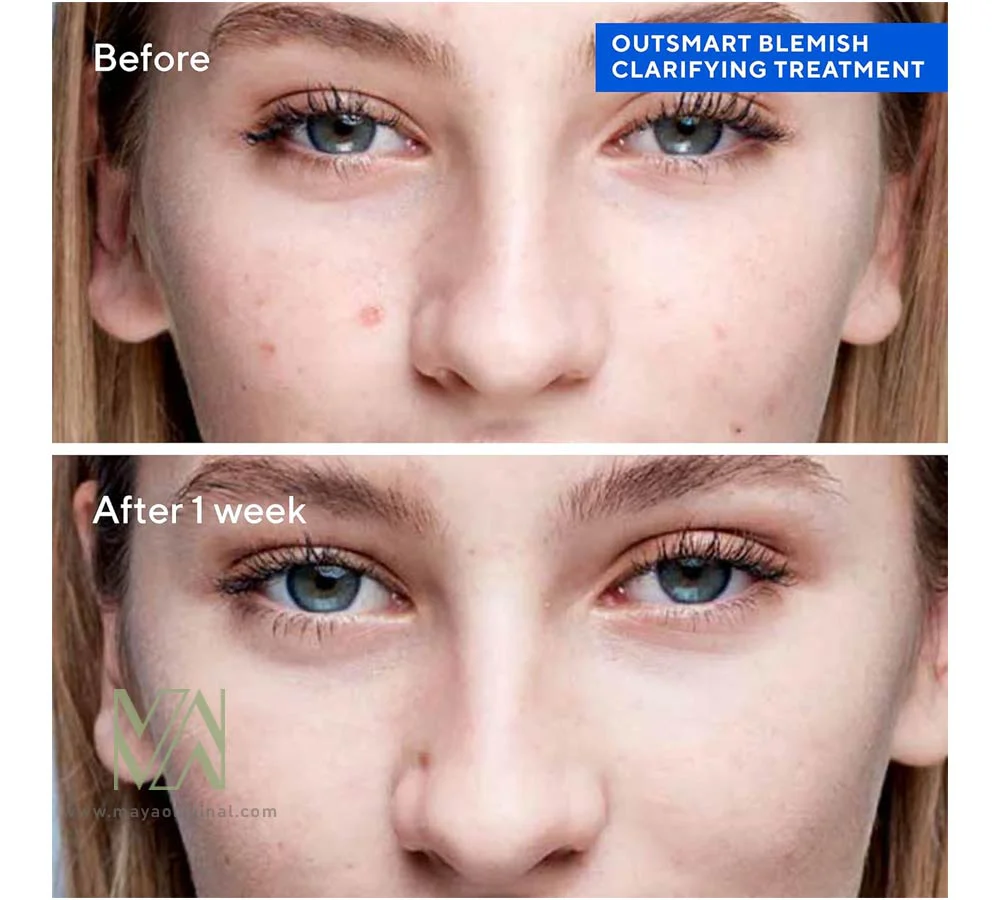 خرید ضد آفتاب بلمیش کنترل مورد murad اصل