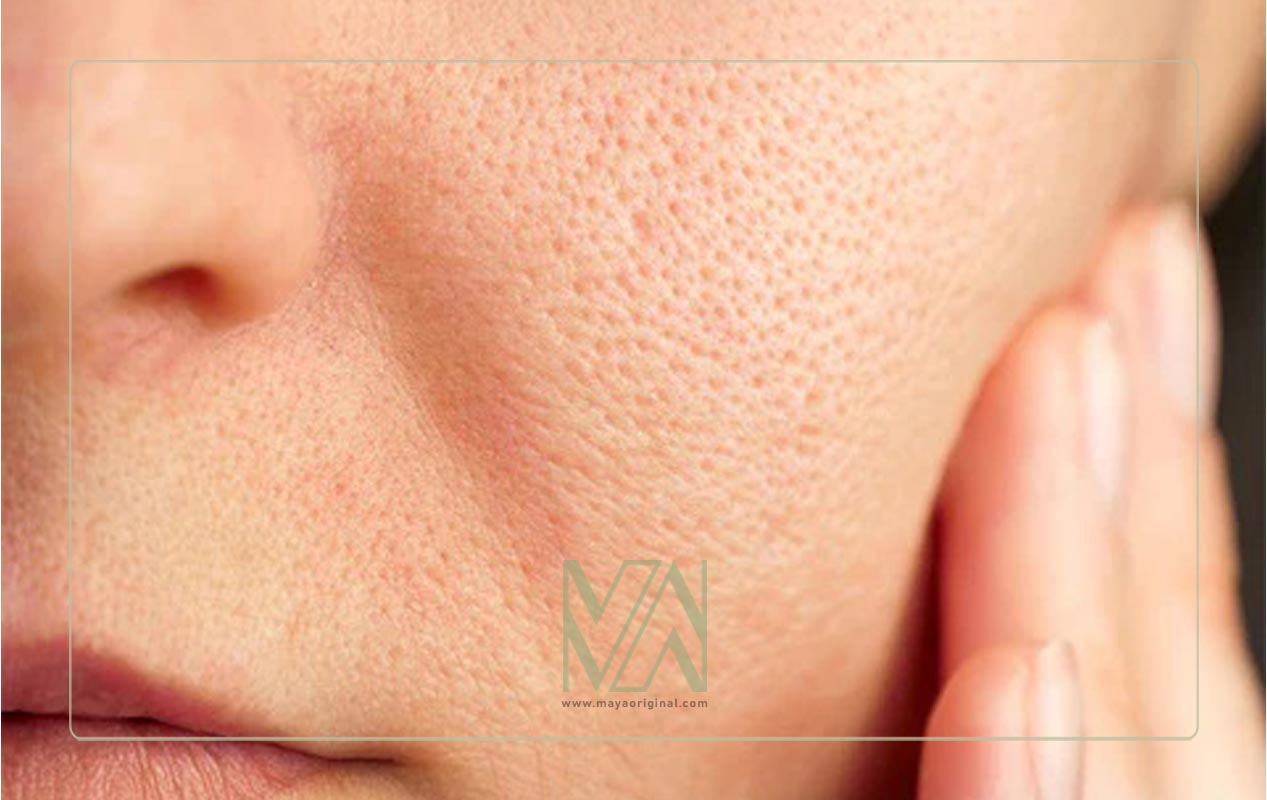 آبرسان و منافذ باز پوست