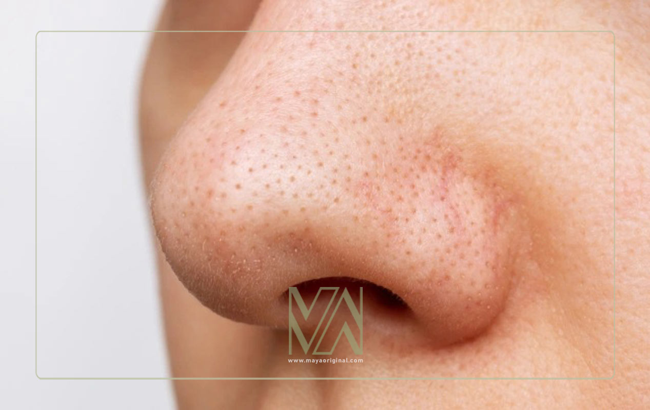 نقش آبرسان روی منافذ پوست