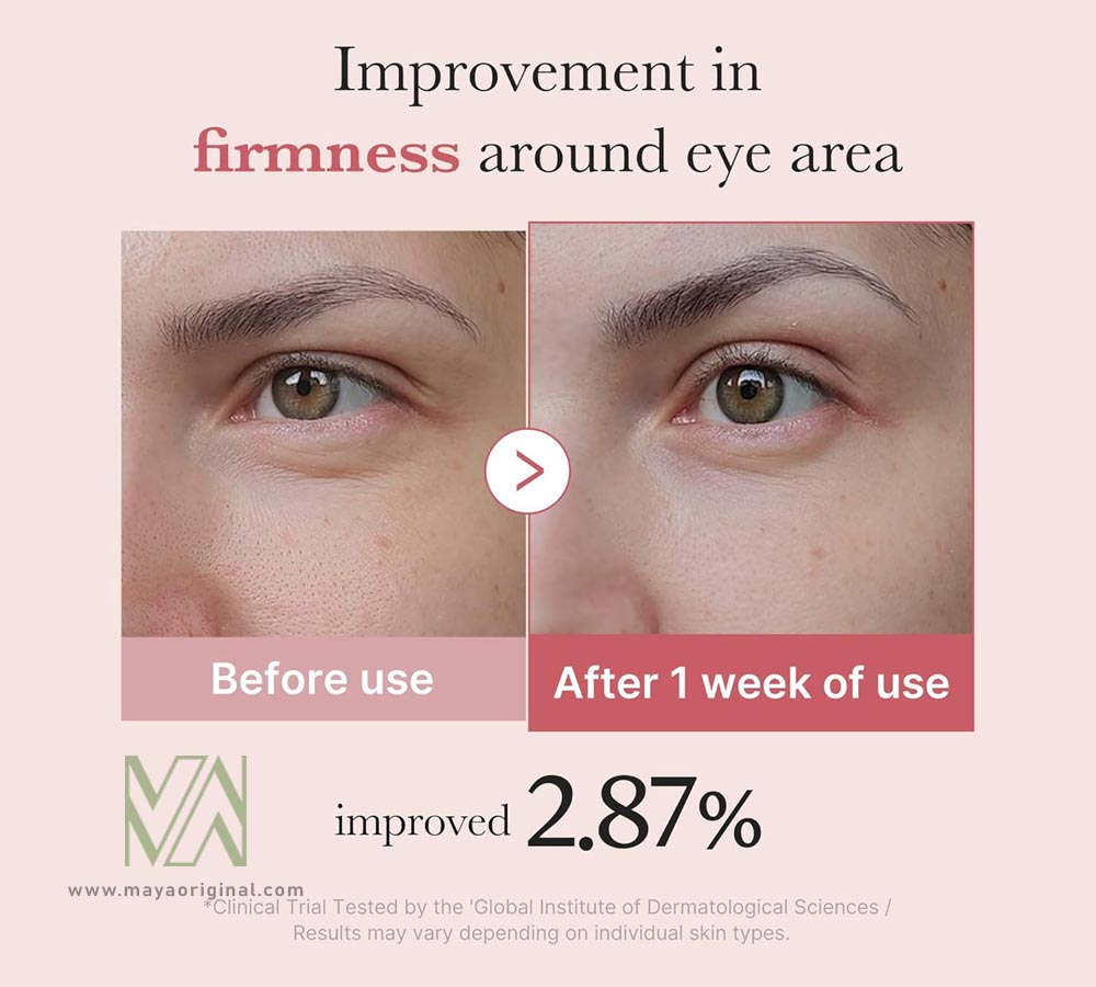 medicube-pdrn-pink-peptide-eye-cream-maya-04 کرم دور چشم پپتاید صورتی مدی کیوب