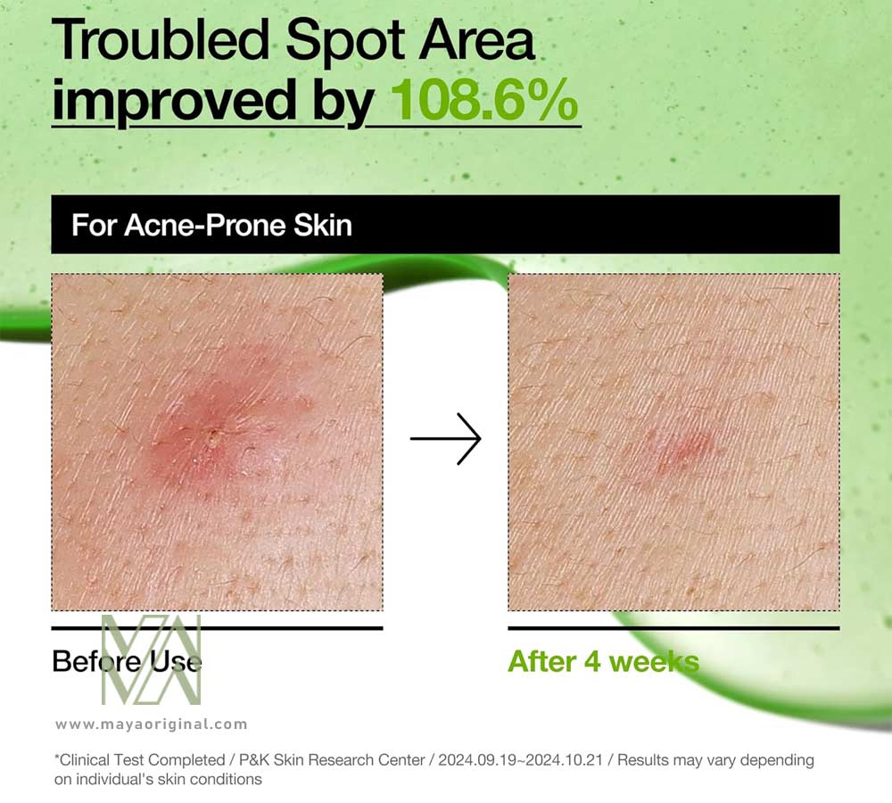 anua-azelaic-acid-10-skin-serum-maya-04 خرید سرم پوست آزلائیک اسید 10 + آنوا اصل