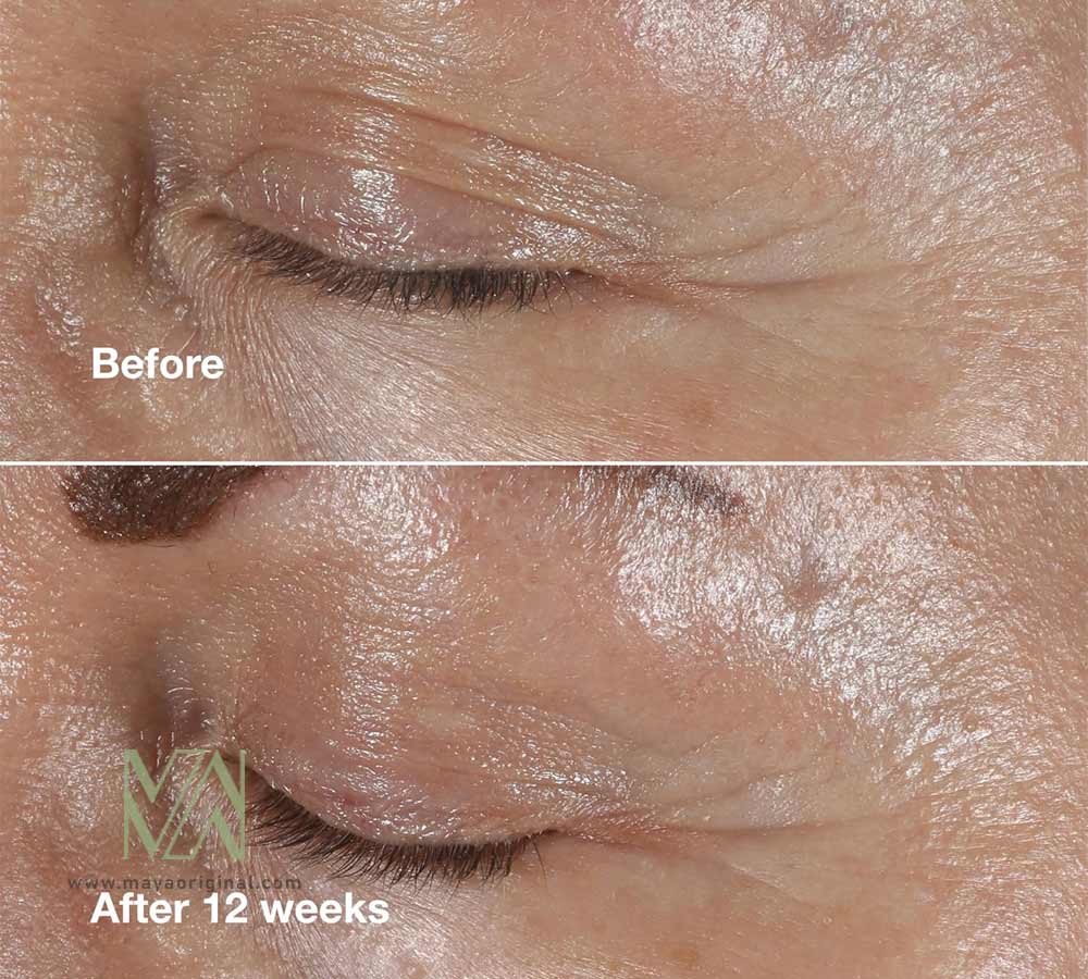 clinique-smart-clinical-repair-eye-cream-maya-03 کرم دورچشم اسمارت کلینیک