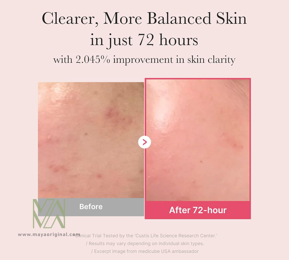 medicube-txaniacinamide-serum-maya-02 سرم نیاسینامید مدی کیوب