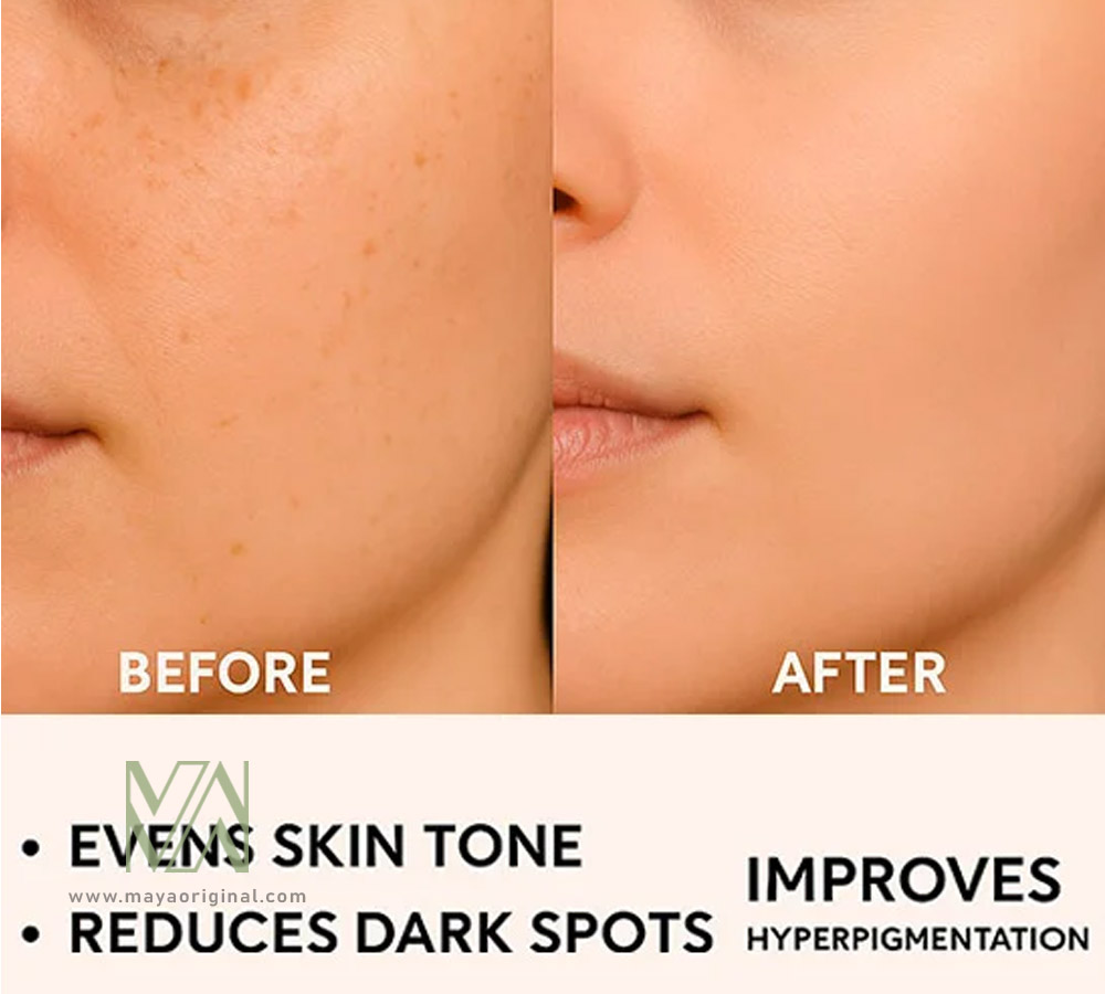 sea-el-cysteamine-cream-maya-03 کرم ضدلک سیستئامین سی ال